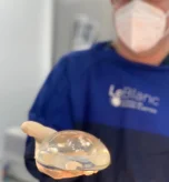 Mamoplastia de Aumento Dr Julian Pacheco